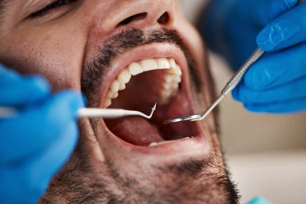 Best Emergency Dental Extractions in Tulia, TX