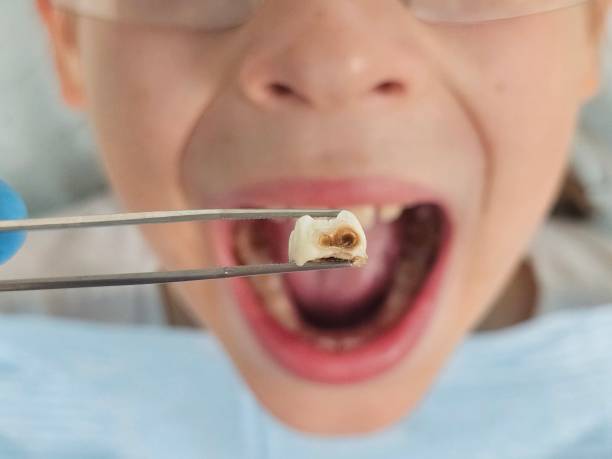 Best Weekend Emergency Dentist in Tulia, TX